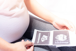 Woman looking at ultrasounds